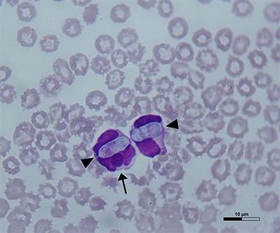 Concomitant Infections With Canine Parvovirus Type 2 and Intracellular Tick-Borne Pathogens in Two Puppy Dogs